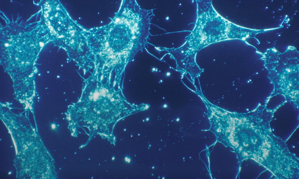 BEING DYSLEXIC SHOULD NOT TRANSLATE TO BEING MELANCHOLIC.