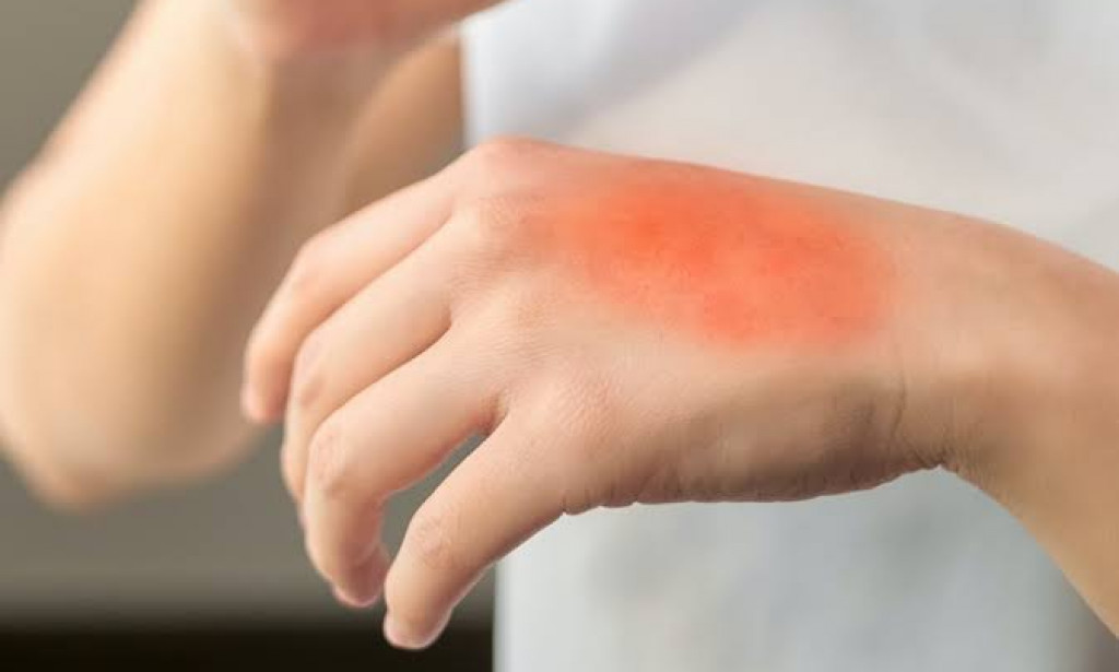 Things You Need To know about Skin Cancer Prevention