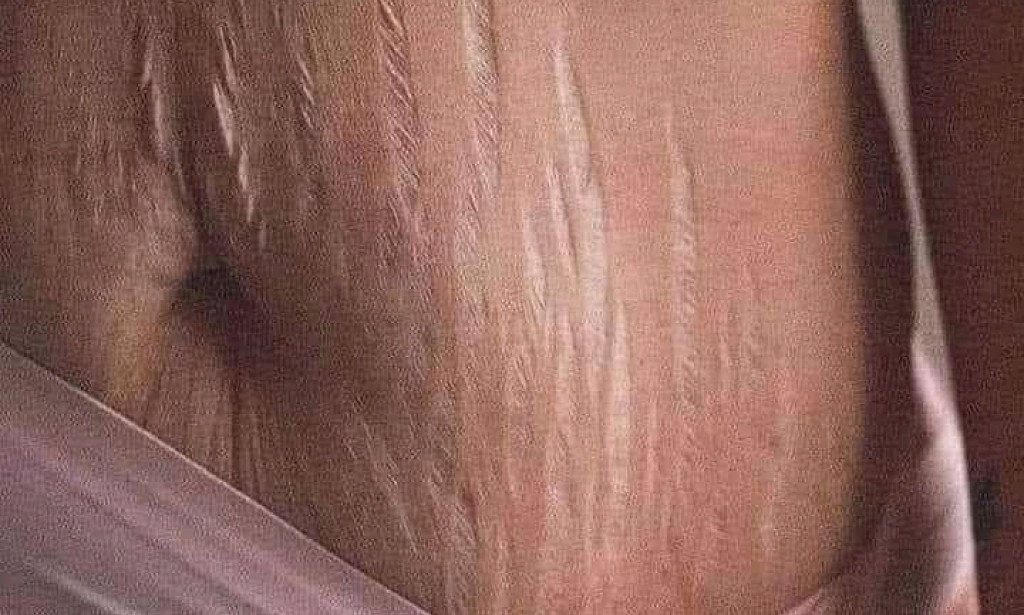 THE CONCEPT OF IMMUNITY IN HUMAN BEINGS