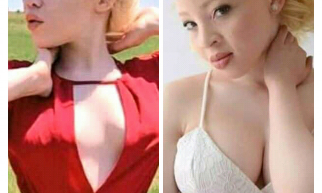 Check Out These 10 Photos of Albino Cute Ladies