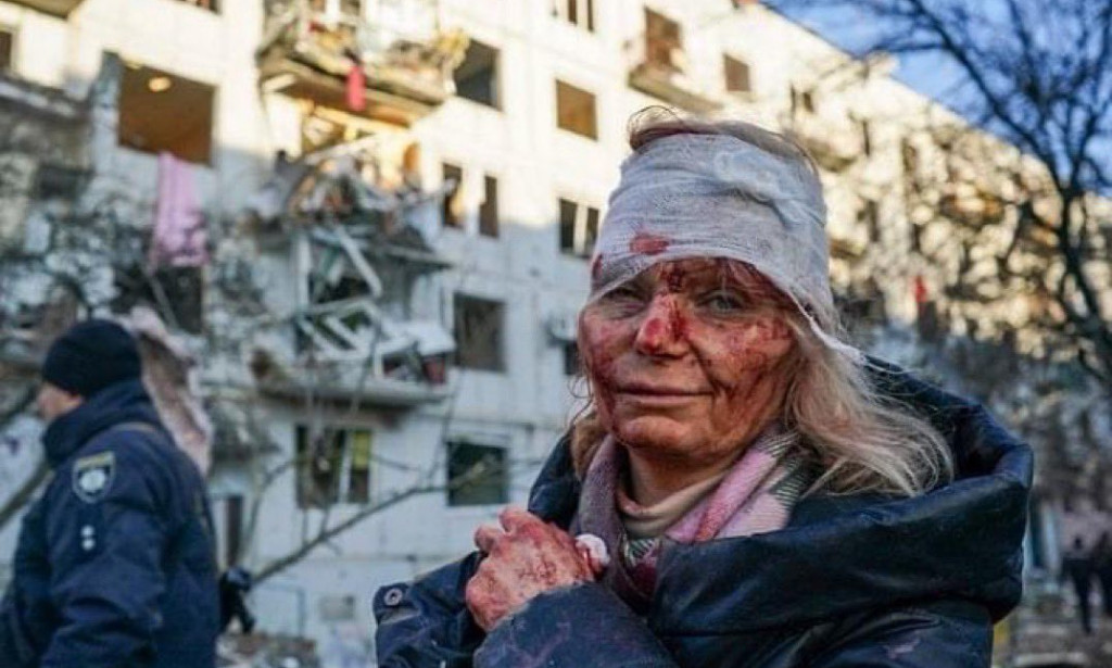 SHAME TO THE BIG NAMES FOR WHAT IS HAPPENING IN UKRAINE