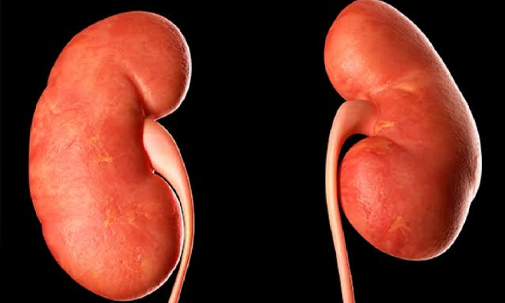 3 Common Causes of Kidney Problems and How to Prevent Them.