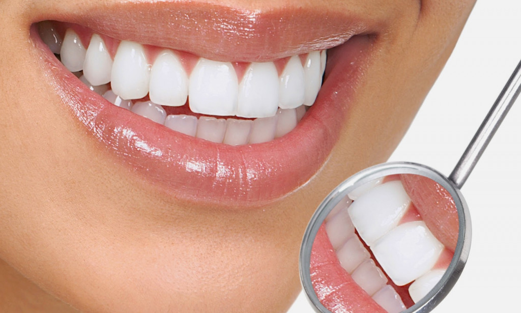 How To Protect Your Smile.