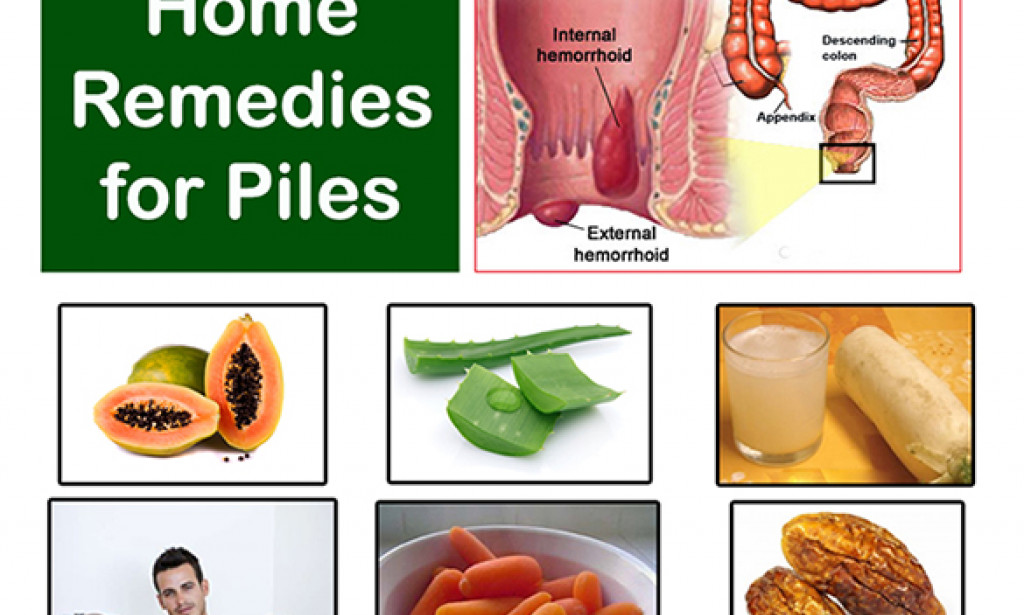Step By Step Instructions To Fix Piles Effectively With Herbal Treatment