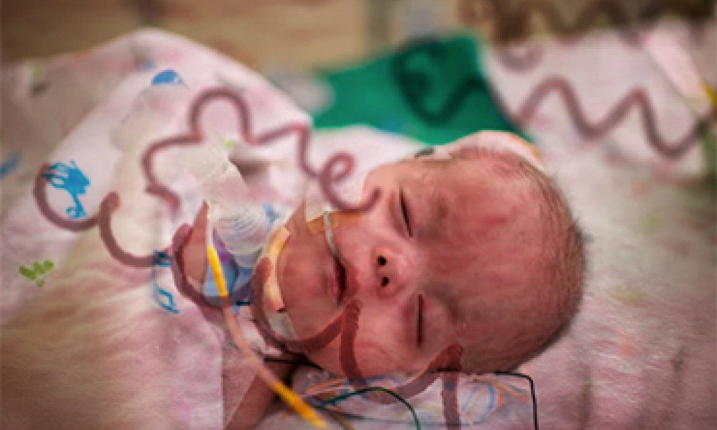 (congenital syphilis) killing babies