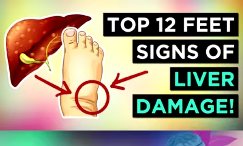 Top 12 Feet Signs of Liver Damage