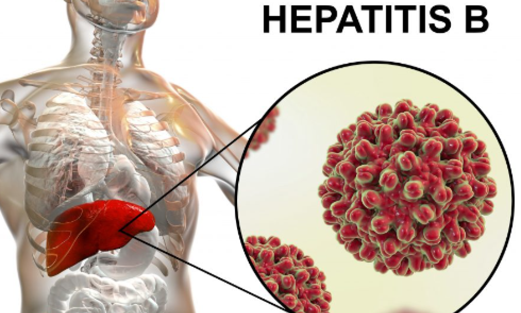 LIFE SAVING PREVENTIVE MEASURES AGAINST HEPATITIS B INFECTION
