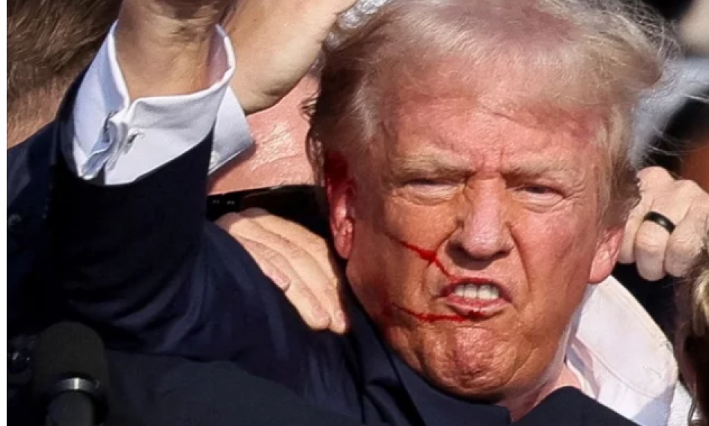 Survival of former US president Donald Trump