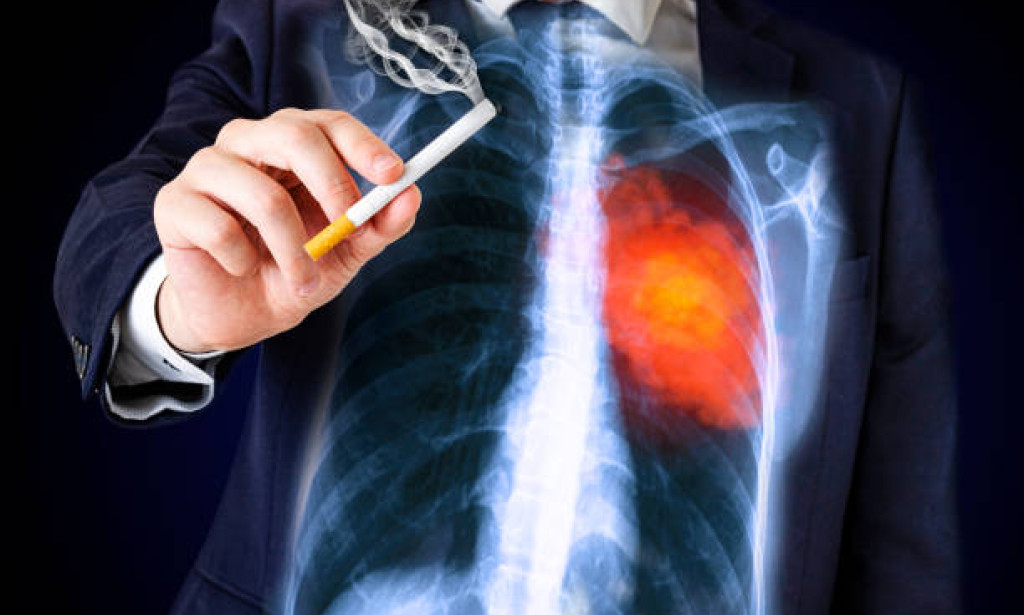 The Risks of Smoking: Why Immediate Cessation is Essential