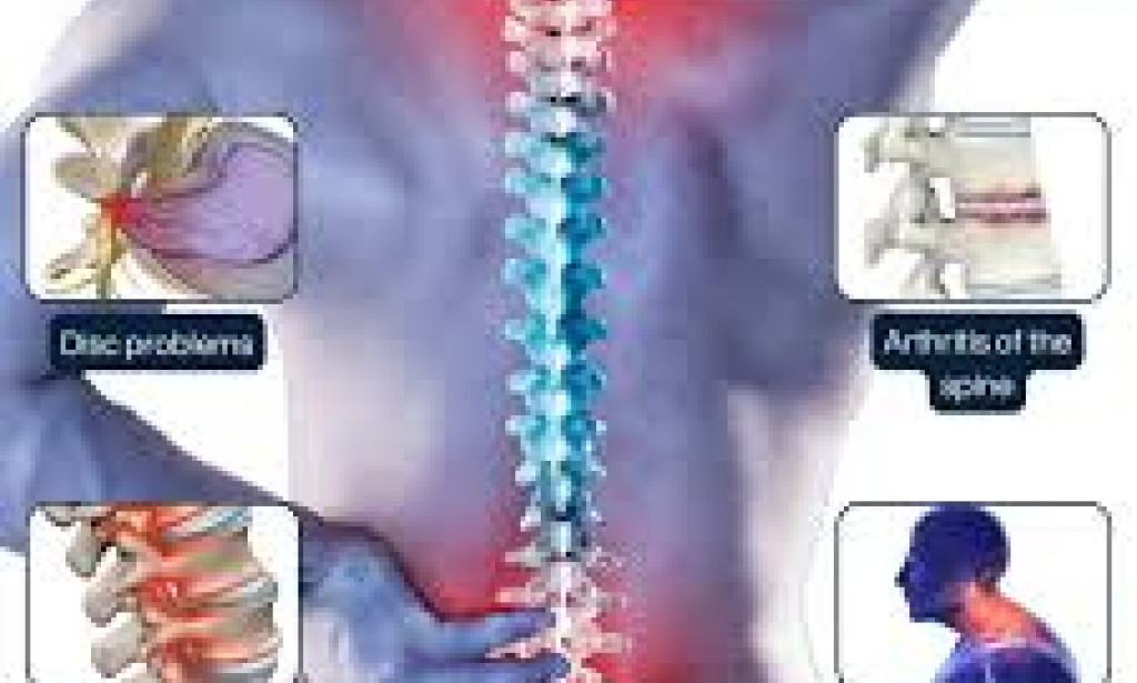 Chronic Back Problems: Can Gabapentin 100mg Be the Solution?