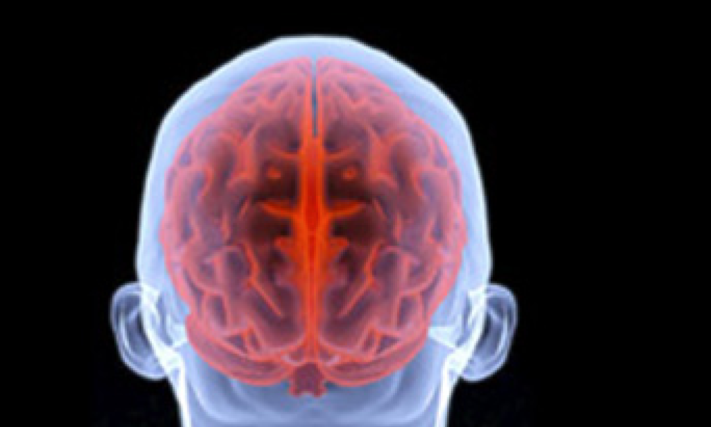 Unveiling The Effects Of Traumatic Brain Injury You Might Not Know