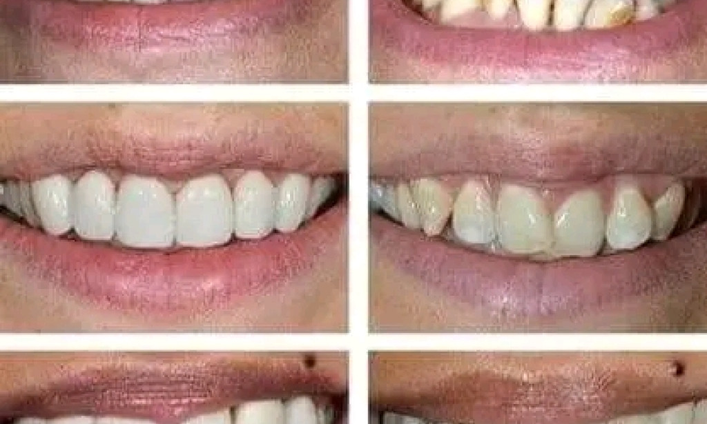 The Development of Teeth