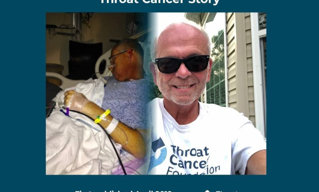 ROBERT'S HPV-RELATED THROAT CANCER STORY